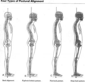 La posture de gauche est la posture idéale: celle qui aligne le lobe de l'oreille avec la pointe de l'épaule et le bassin.